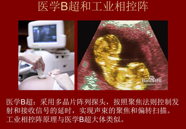 工業相控陣原理與醫學B超大體類似，醫學B超采用多晶片陣列探頭，按照聚焦法則控制發射和接收信號的延時，實現聲束的聚焦和偏轉掃描